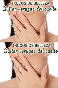 Eliminar verrugas del cuello, senos, pecho, axilas, manos y pies