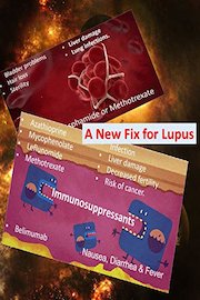 A New Fix for Lupus