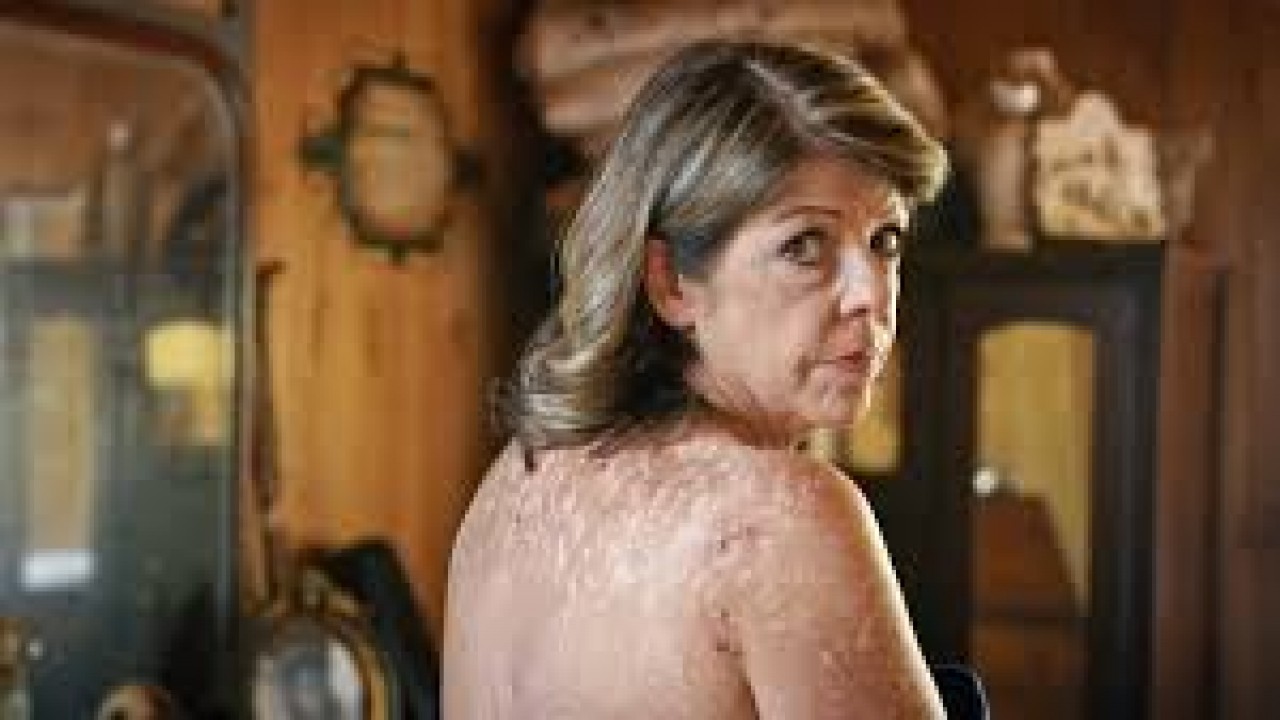 Skin Deep: The Battle Over Morgellons