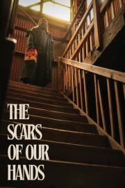 The Scars of Our Hands