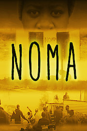 Noma