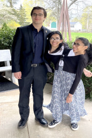 Conjoined Twins: Inseparable