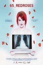 65 Redroses