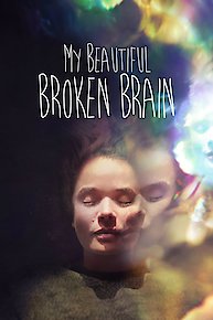 My Beautiful Broken Brain