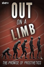 Out on a Limb: The Promise of Prosthetics