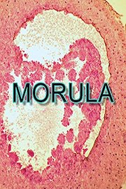 Morula