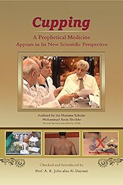 Cupping: A prophetical medicine appears in its new scientific perspective