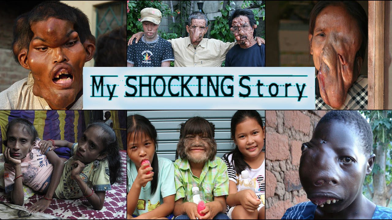 My Shocking Story