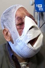 The Man Who Lost His Face