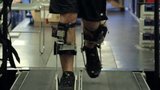 Meet the Double Amputee Building the New Bionic Man