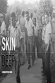 Skin Deep