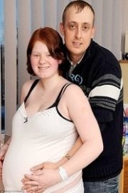 Britain's Conjoined Twins: Hope and Faith