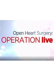 Operation Live